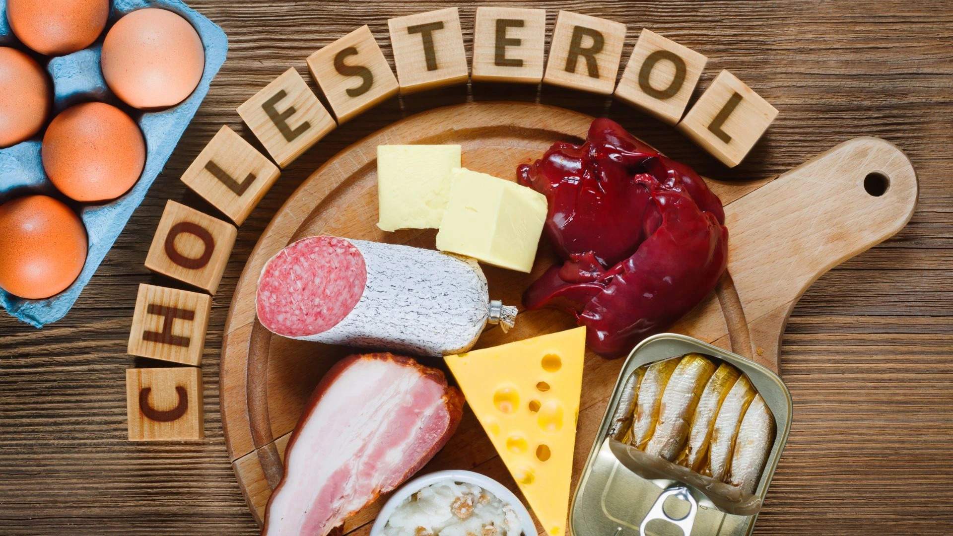 Ako sa zbaviť vysokého cholesterolu Toto sú naše odporúčaniaa
